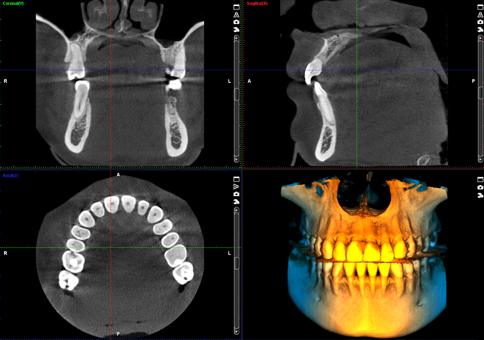 CBCT scan in Dubai